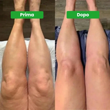 Drenante Linfatico