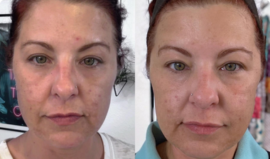 Say Goodbye To Dull, Aging Skin & Deep Wrinkles with a simple daily ritual