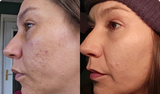 Say Goodbye To Dull, Aging Skin & Deep Wrinkles with a simple daily ritual