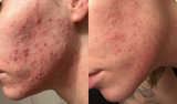 Say Goodbye To Dull, Aging Skin & Deep Wrinkles with a simple daily ritual