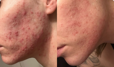 Say Goodbye To Dull, Aging Skin & Deep Wrinkles with a simple daily ritual