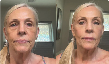 Say Goodbye To Dull, Aging Skin & Deep Wrinkles with a simple daily ritual